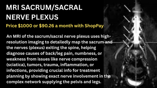 MRI SACRUM/SACRAL NERVE PLEXUS
