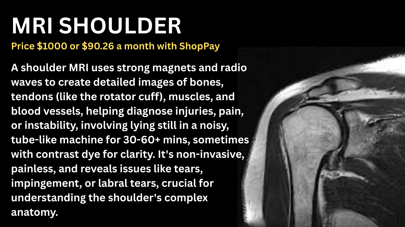 MRI SHOULDER