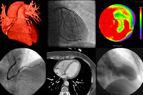 ULTRASOUND HEART ECHOCARDIOGRAM